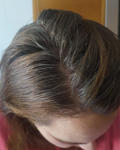 Antes