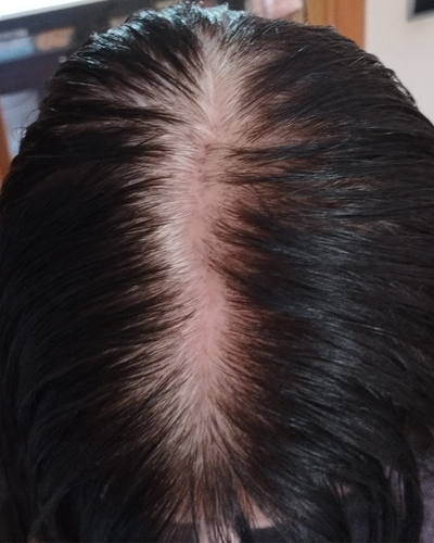 Antes