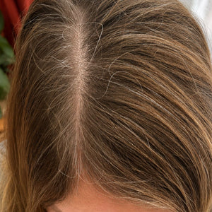 Antes