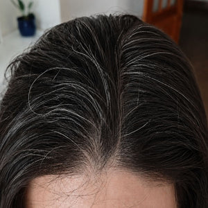 Antes