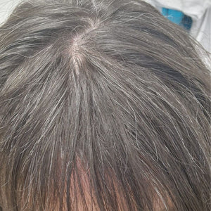 Antes